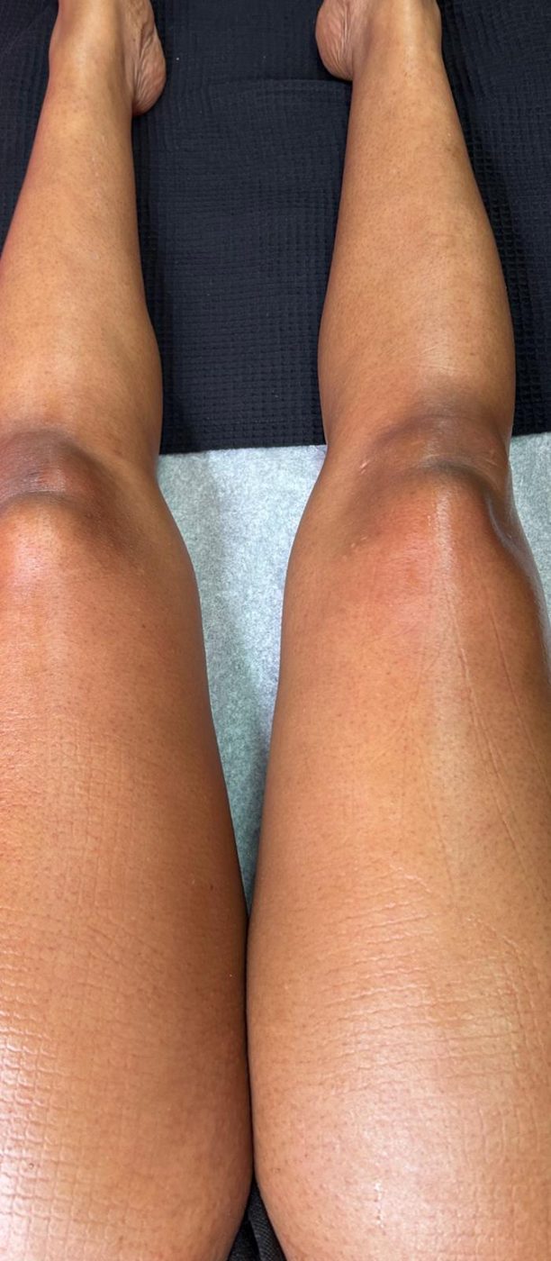 Wax Moi client result