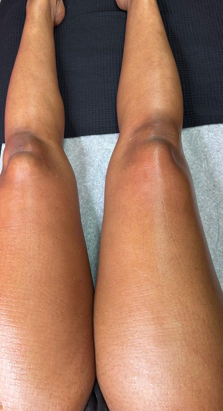 Wax Moi client result