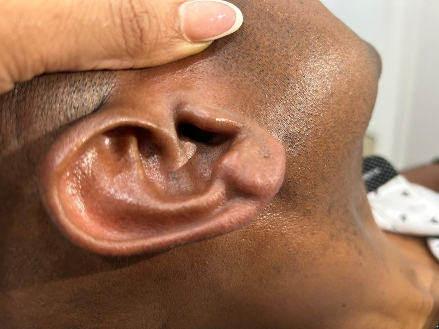 Wax Moi client result