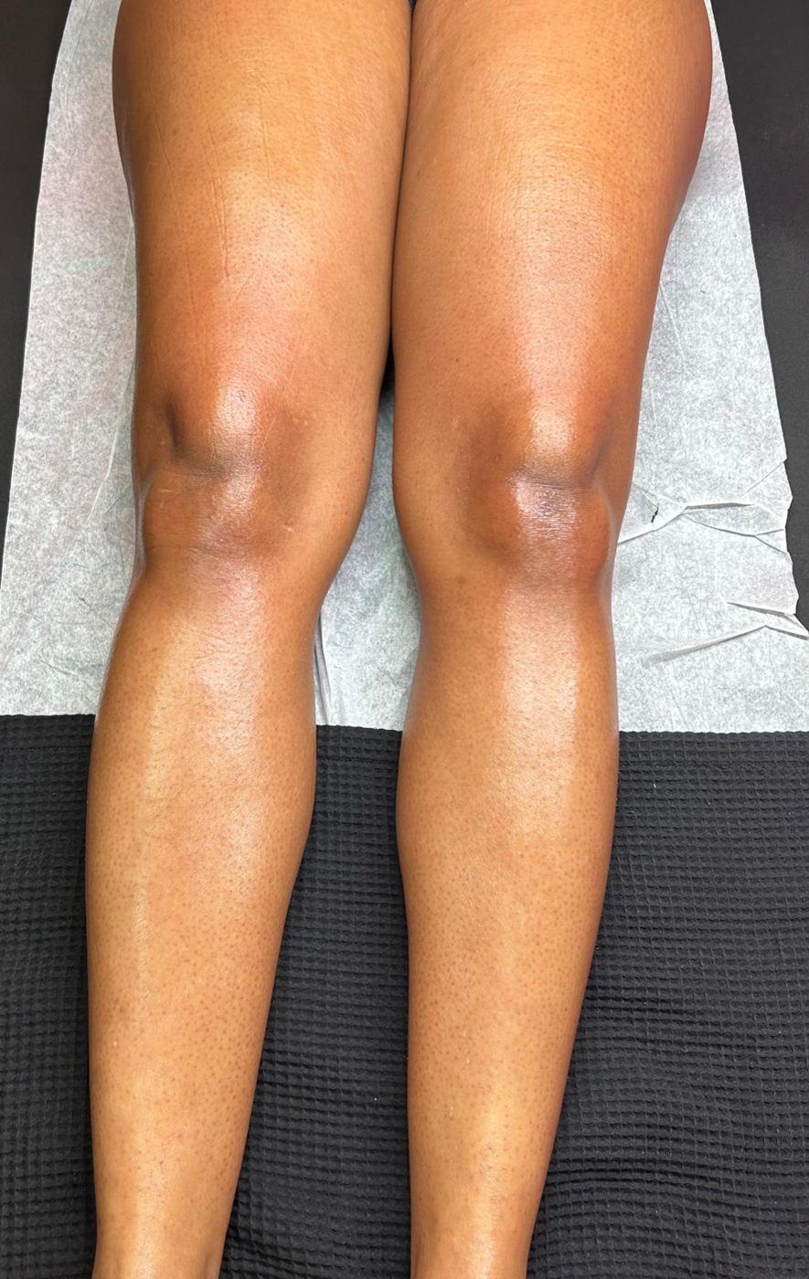Wax Moi client result