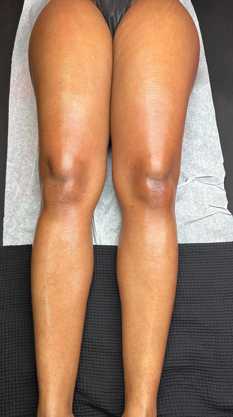 Wax Moi client result